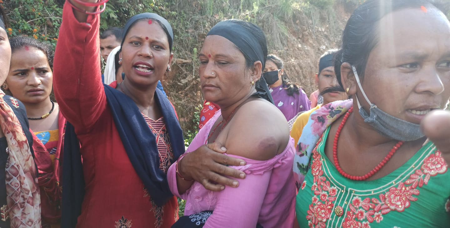 रुकुम सोती हत्याकाण्डः पोष्टमार्टम रिपोर्ट बाहिरिएपछि आन्दोलन,प्रहरीद्धारा हवाई फायर